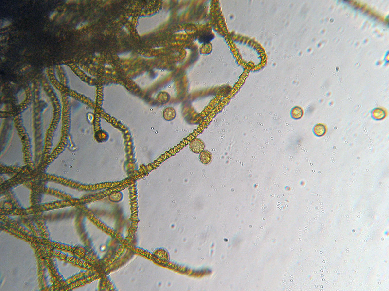 Mixomicete natalizio - Trichia scabra